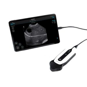 Ecógrafo SONOEYE P6 VET - CHISON